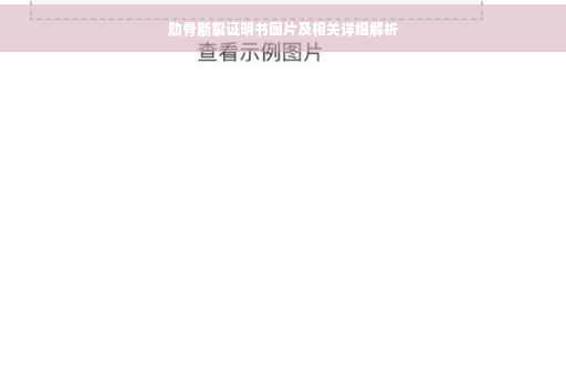肋骨断裂证明书图片及相关详细解析