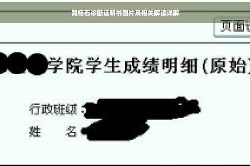 肾结石诊断证明书图片及相关解读详解