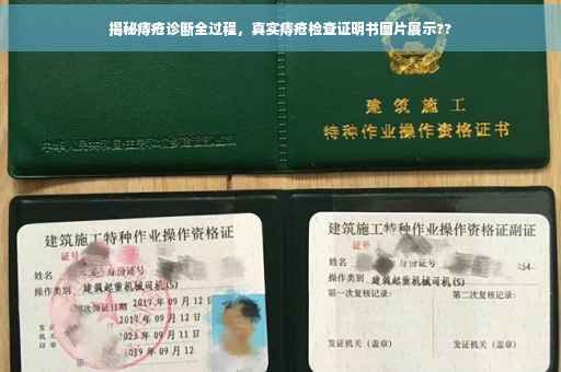 揭秘痔疮诊断全过程，真实痔疮检查证明书图片展示??