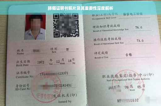 肺癌证明书照片及其重要性深度解析
