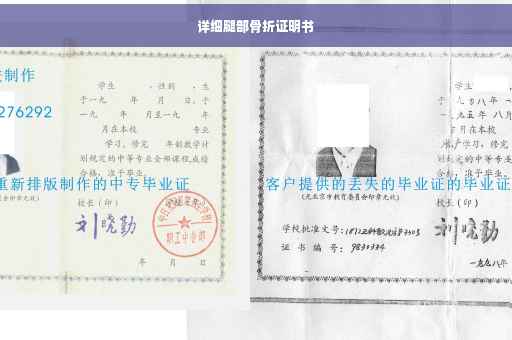 详细腿部骨折证明书