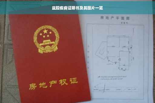 盆腔疾病证明书及其图片一览