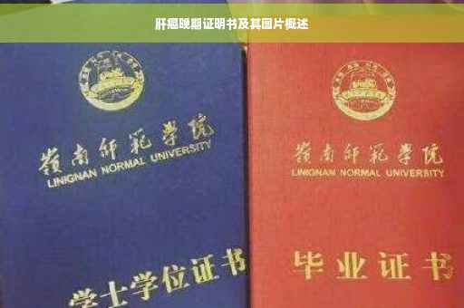 肝癌晚期证明书及其图片概述