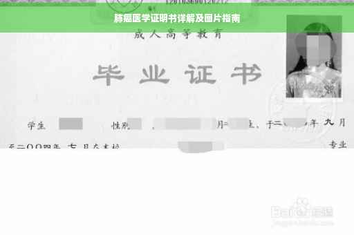 肺癌医学证明书详解及图片指南