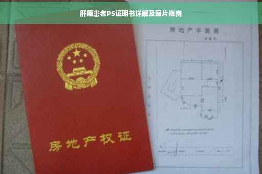 肝癌患者PS证明书详解及图片指南