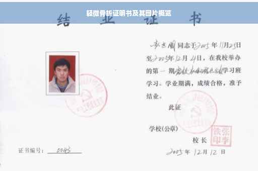 轻微骨折证明书及其图片概览