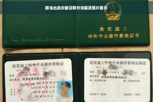 肺泡出血诊断证明书详解及图片展示