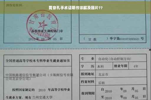 胃穿孔手术证明书详解及图片??