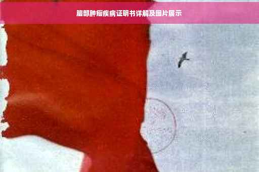 脑部肿瘤疾病证明书详解及图片展示