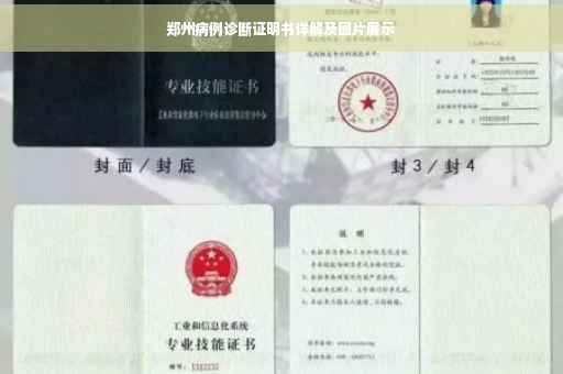 郑州病例诊断证明书详解及图片展示