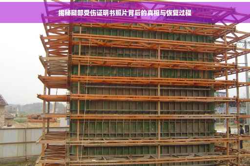 揭秘腿部受伤证明书照片背后的真相与恢复过程