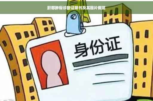 肝部肿瘤诊断证明书及其图片概览