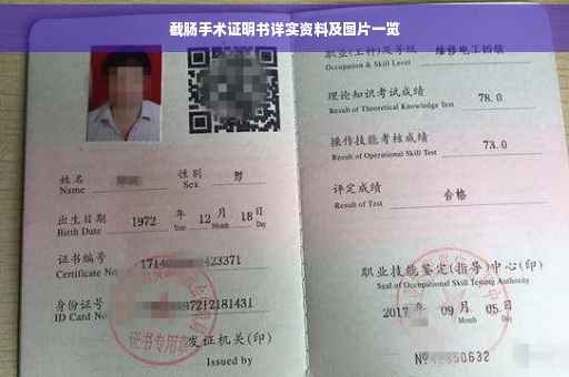 截肠手术证明书详实资料及图片一览