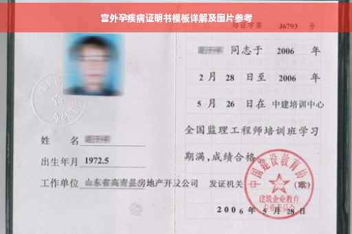 宫外孕疾病证明书模板详解及图片参考