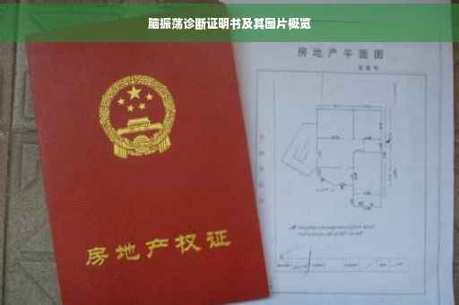 脑振荡诊断证明书及其图片概览