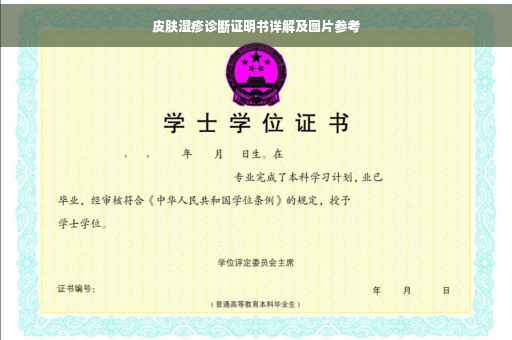 皮肤湿疹诊断证明书详解及图片参考