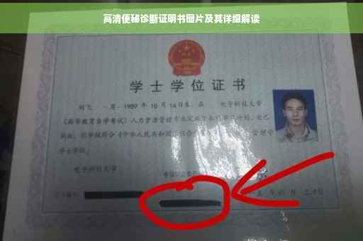 高清便秘诊断证明书图片及其详细解读