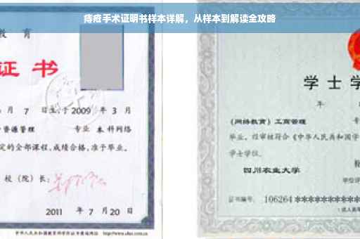痔疮手术证明书样本详解，从样本到解读全攻略