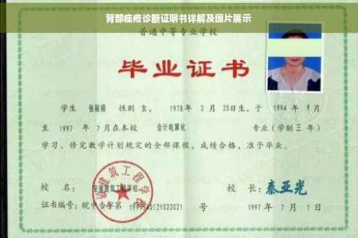 背部痤疮诊断证明书详解及图片展示