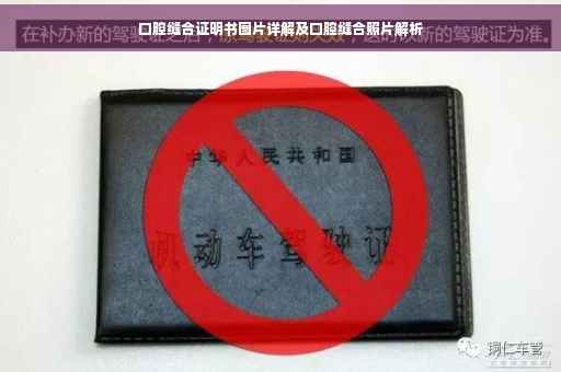 口腔缝合证明书图片详解及口腔缝合照片解析