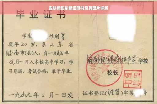 皮肤抓伤诊断证明书及其图片详解
