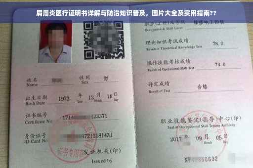 肩周炎医疗证明书详解与防治知识普及，图片大全及实用指南??