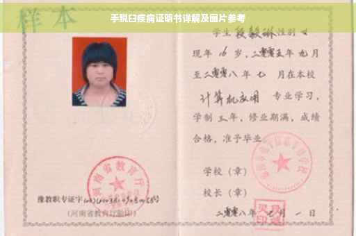 手脱臼疾病证明书详解及图片参考