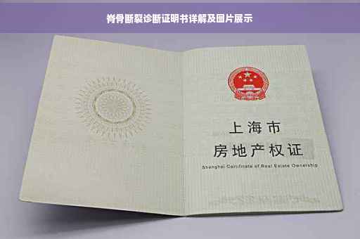 脊骨断裂诊断证明书详解及图片展示