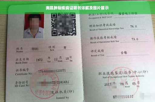 南昌肿瘤疾病证明书详解及图片展示