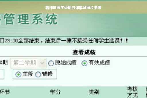 精神症医学证明书详解及图片参考